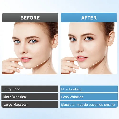 Dispositivo de adelgazamiento facial.